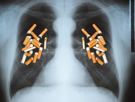 קופות חולים מפעילות סדנאות גמילה מעישון לטובת ציבור המעשנים